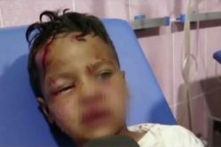 فيديو.. كلب مسعور يهاجهم 8 أشخاص في البيض وينهش أجسامهم