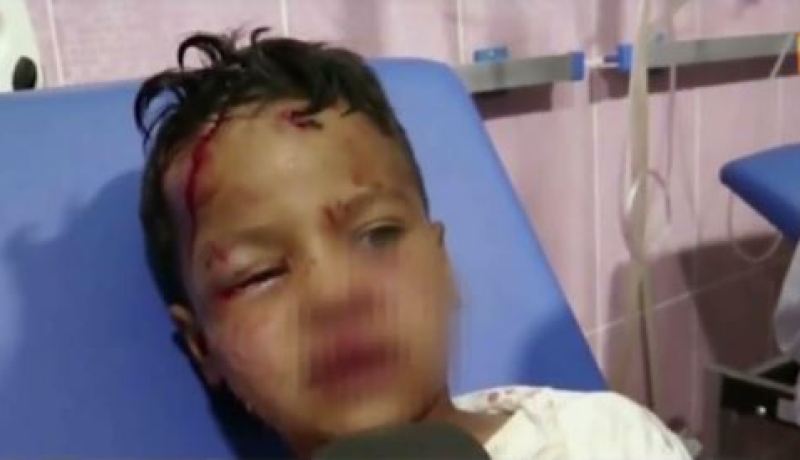 فيديو.. كلب مسعور يهاجهم 8 أشخاص في البيض وينهش أجسامهم