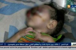 وزير الصحة يتعهد بالتكفل بحالة الرضيع إبراهيم مؤيد