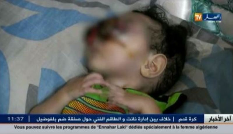 وزير الصحة يتعهد بالتكفل بحالة الرضيع إبراهيم مؤيد