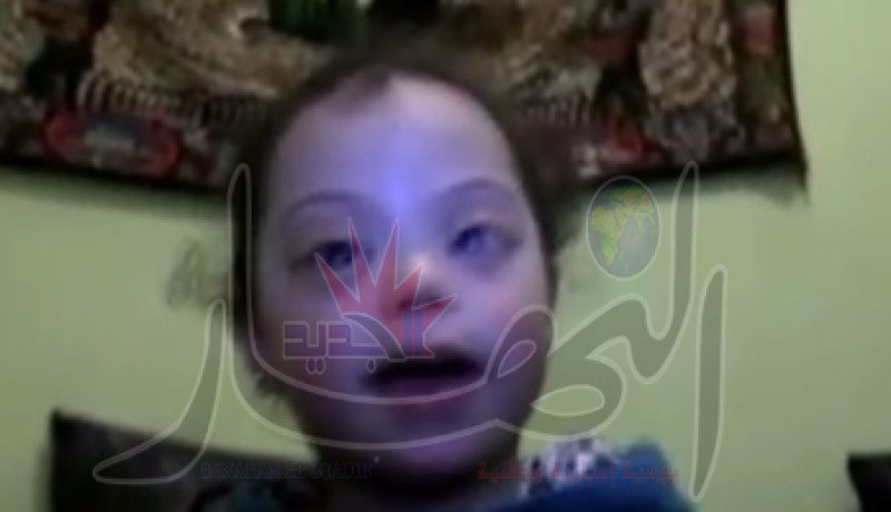 أخيرا الطفلة نهال تطير إلى اسبانيا للعلاج