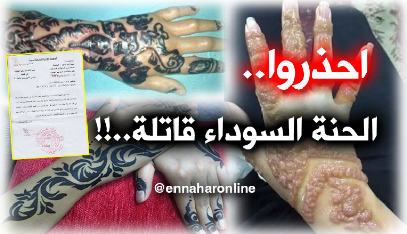 وزارة التّجارة تحذّر من حنّاء قاتلة.. !!