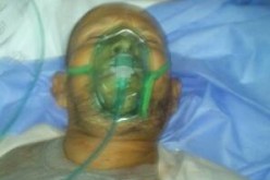 بتر قدمي حاجين جزائريين وإخضاع 6 آخرين لعمليات جراحية