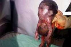 سيدة تضع مولوداً برأس إنسان وأرجل ماعز