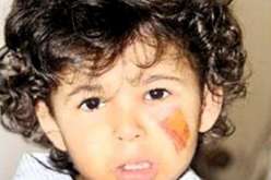 خادمة إثيوبية تحرق وجه طفل بمكواة في جدة