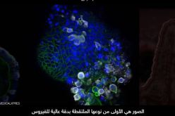 كشف أول صور تفصيلية تظهر شكل “فيروس كورونا” الحقيقي