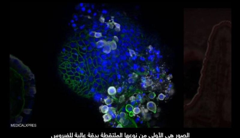 كشف أول صور تفصيلية تظهر شكل “فيروس كورونا” الحقيقي