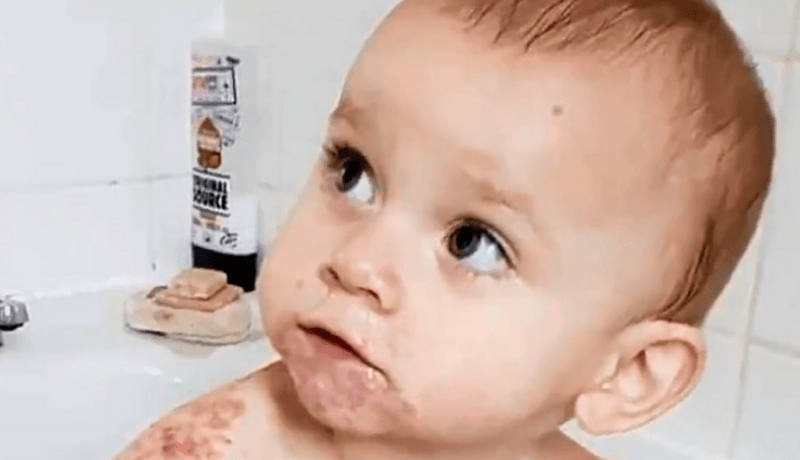 احذروا..”قبلة” على فم رضيعة كادت أن “تقتلها”