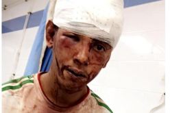 مستوطنون مغاربة يعتدون على شاب صحراوي في العيون المحتلة