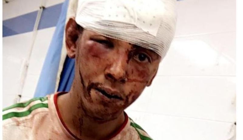 مستوطنون مغاربة يعتدون على شاب صحراوي في العيون المحتلة