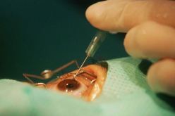 علاج جديد للعمى في مواجهة التكلفة الباهظة