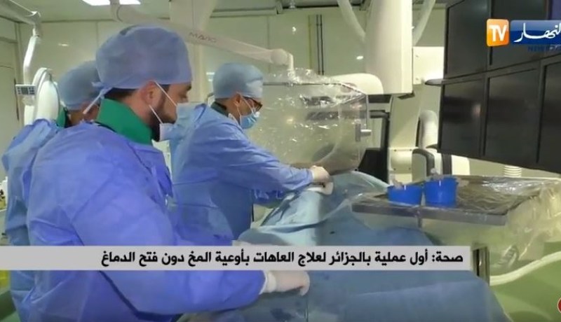 أول عملية جراحية لعلاج العاهات دون فتح دماغ المريض في الجزائر