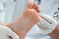 بتر قدم ممثل مصري بعد إصابته خلال التصوير