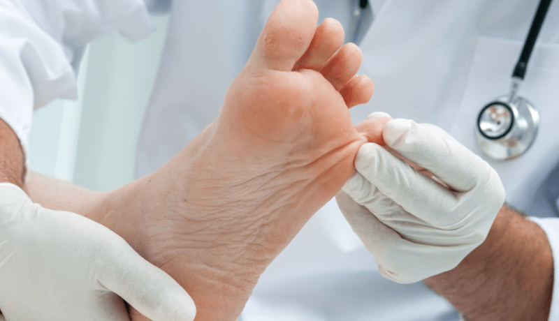 بتر قدم ممثل مصري بعد إصابته خلال التصوير