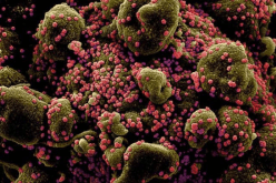 في حالة نادرة.. تسعينية تتوفي بعد إصابتها بسلالتي كورونا في نفس الوقت