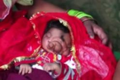 فيديو طفلة تولد بخرطوم فيل وأهلها يفرحون بذلك في الهند