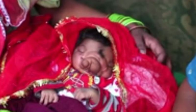 فيديو طفلة تولد بخرطوم فيل وأهلها يفرحون بذلك في الهند