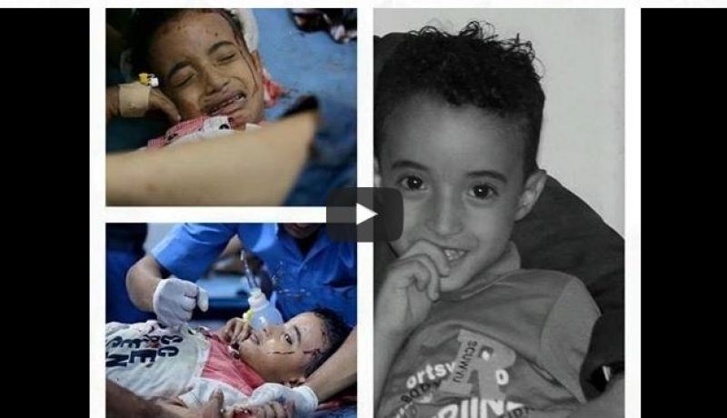 فيديو الطفل فريد يفارق الحياة إثر قذيفة حوثية وهو يردد كلمة لا تقبروناش