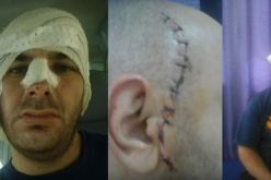 بالفيديو عون أمن يعتدي على رجل أحضر زوجته للولادة في مستشفى بويرة