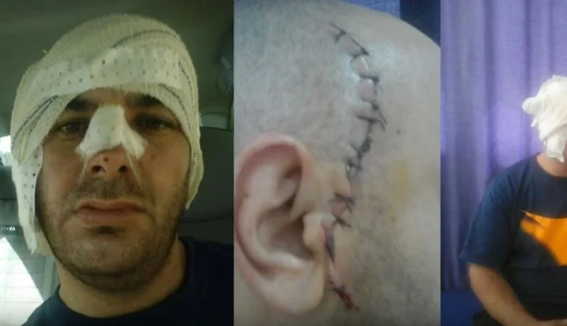 بالفيديو عون أمن يعتدي على رجل أحضر زوجته للولادة في مستشفى بويرة