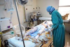 “الطابونة” و”الشربة” تحرق 30 طفلا يوميا في رمضان