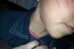 بالصور تلميذ يتعرض لاعتداء وحشي من طرف والده بسبب المعدل الفصلي