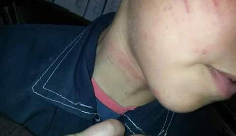 بالصور تلميذ يتعرض لاعتداء وحشي من طرف والده بسبب المعدل الفصلي