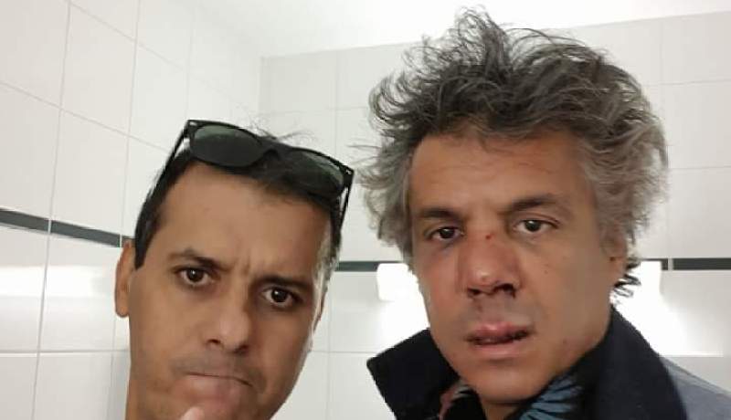 نكاز.. ضحية اعتداء أم «طاح في مول الفول»؟