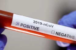 خبراء يدعون إلى تسقيف سعر تحاليل الكشف السريع عن كورونا