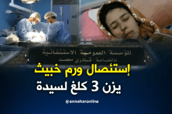 فريق طبي ينجح في إستئصال ورم خبيث يزن 3 كلغ بالنعامة  