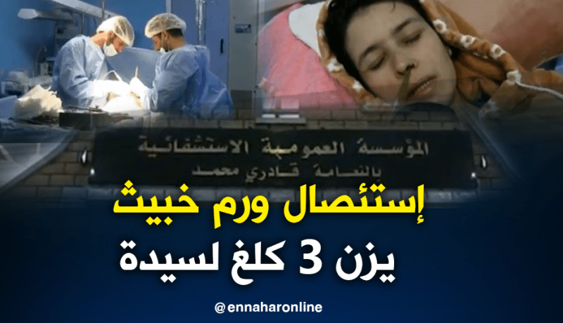 فريق طبي ينجح في إستئصال ورم خبيث يزن 3 كلغ بالنعامة