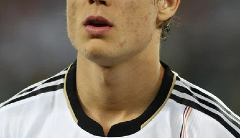 بادشتوبر يغيب 14 يوما على الاقل عن الملاعب