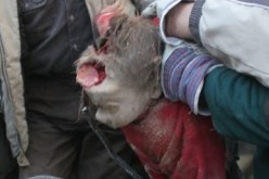 إسرائيل استخدمت غازا خطيرا..يخرب الشرايين في الجسم