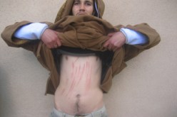 ثلاث بطّالين يجرحون أجسادهم بشفرات حلاقة بمجانة في البرج