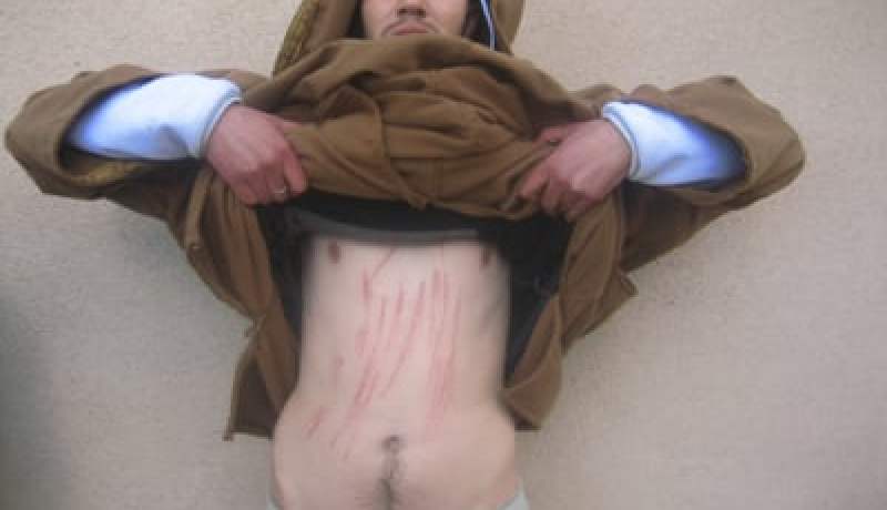 ثلاث بطّالين يجرحون أجسادهم بشفرات حلاقة بمجانة في البرج