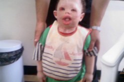 رغم موافقة إحدى المستشفيات الفرنسية على التكفل به : ملف طبي ضائع.. وطرد من العناية المركزة