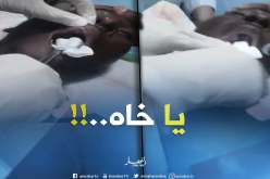 بالفيديو.. لن تصدقوا ما وجده الأطباء داخل فم هذا المريض بالأغواط