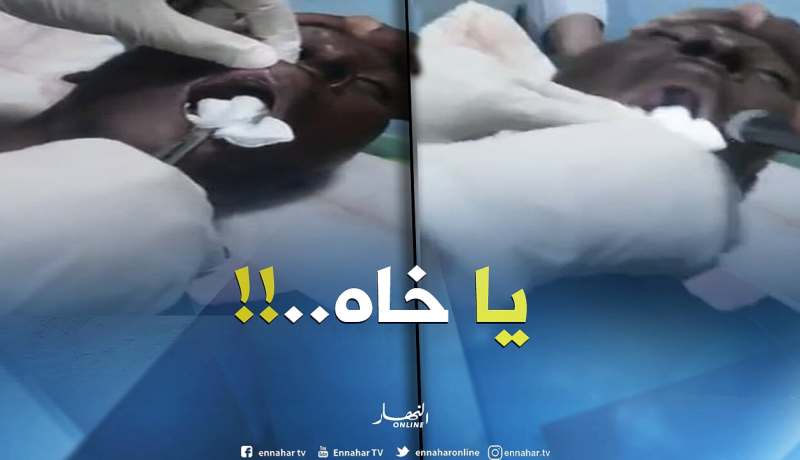 بالفيديو.. لن تصدقوا ما وجده الأطباء داخل فم هذا المريض بالأغواط