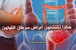 أعراض يصاب بها الإنسان تدل على إصابته بسرطان القولون