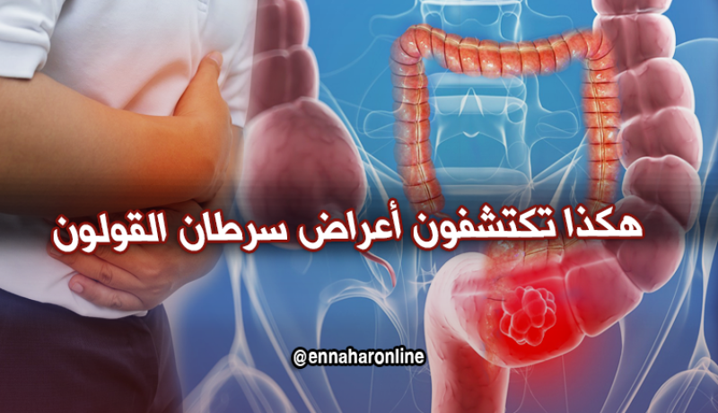أعراض يصاب بها الإنسان تدل على إصابته بسرطان القولون