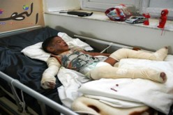 وفاة امرأة أحرقت نفسها احتجاجا على طردها من منزلها بوهران