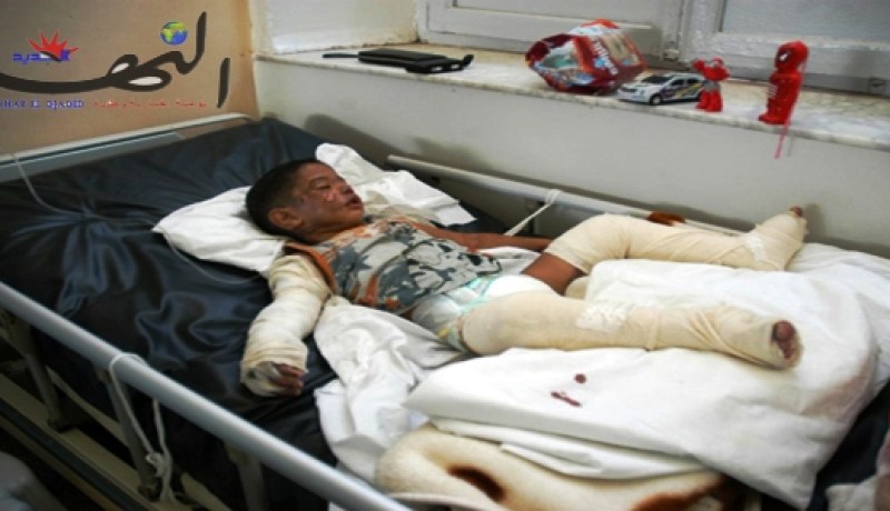 وفاة امرأة أحرقت نفسها احتجاجا على طردها من منزلها بوهران