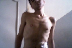 شرب حمضا خطيرا عن طريق الخطأ ظنا منه أنه ماء…أم “سامي” تناشد المحسنين ووزارة التضامن إنقاذ ابنها