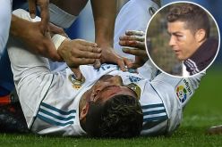 بالصور.. رونالدو يتدرب منتفخ العين !