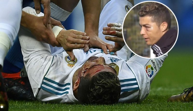 بالصور.. رونالدو يتدرب منتفخ العين !