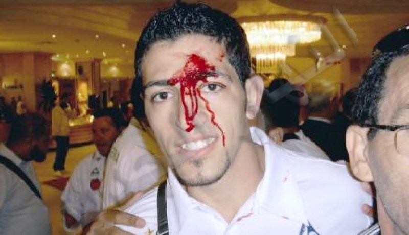 هكذا اعتدى الجبناء على المنتخب الوطني