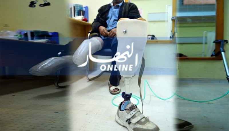 أزيــــد مــــن 900 ألــــف جزائــــري يلجــــأون إلـــى الأعضــــاء الاصطناعيــــة