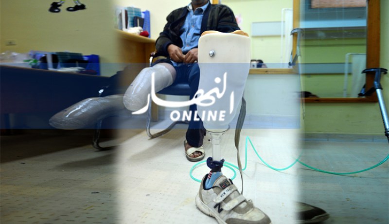 لوناف: تقليص إجراءات ومدة الحصول على الأعضاء الإصطناعية