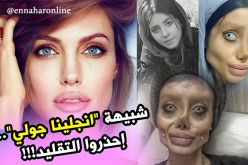 50 عملية جراحية لتتشبه بـ”أنجلينا جولي”.. والنتيجة صادمة !!!