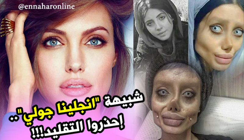 50 عملية جراحية لتتشبه بـ”أنجلينا جولي”.. والنتيجة صادمة !!!